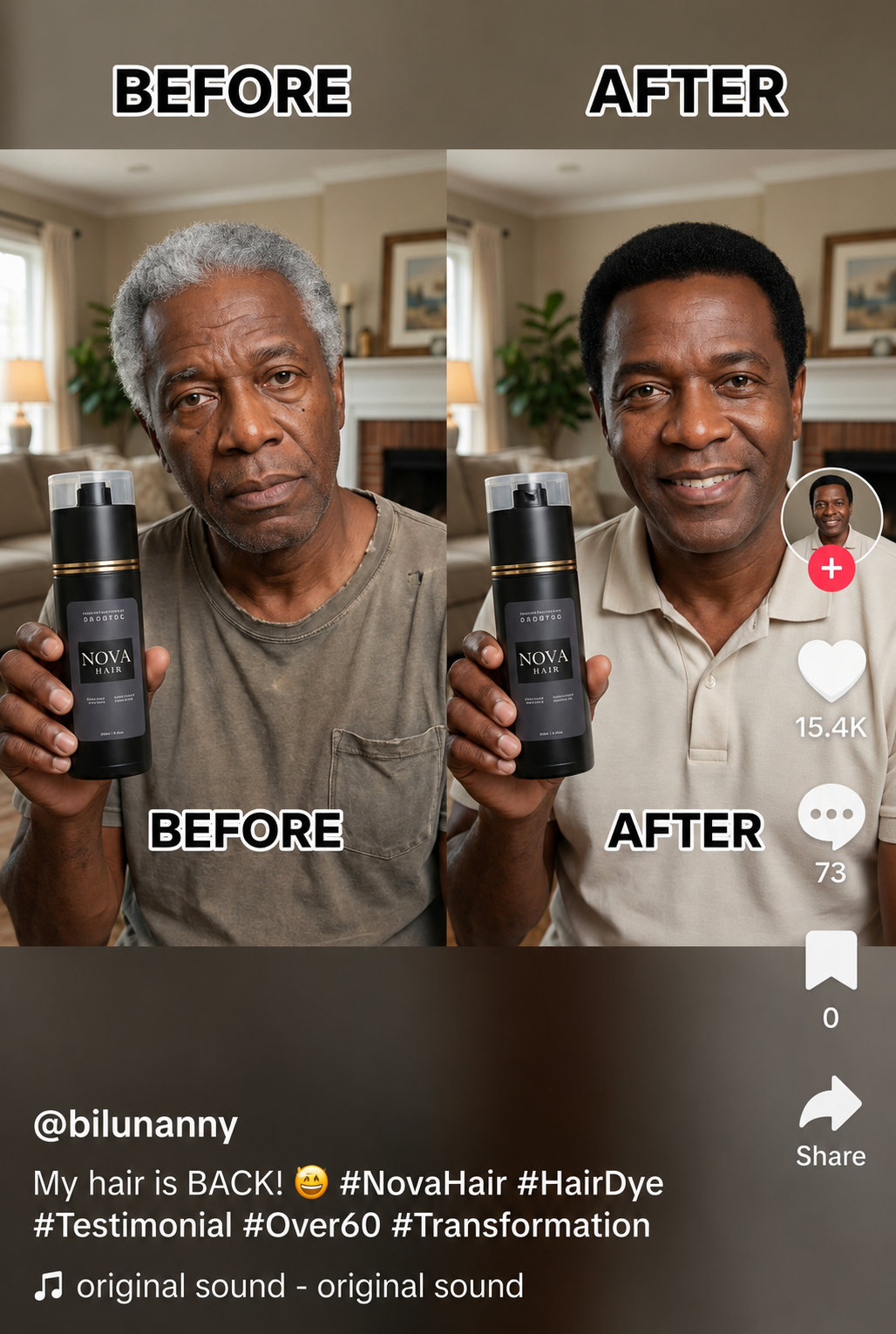 NovaHair before and after — customer result